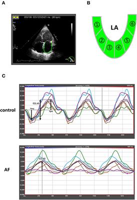 Impaired Left Atrial Performance Resulting From Age-Related Arial Fibrillation Is Associated With Increased Fibrosis Burden: Insights From a Clinical Study Combining With an in vivo Experiment